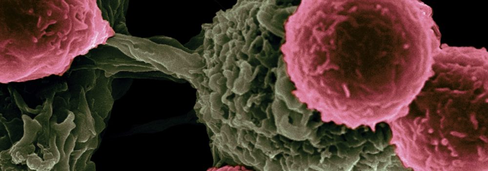 Μύθοι για τον καρκίνο | The Sequel: «η επιστροφή της μούμιας»